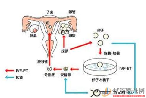 试管婴儿具体流程(图3)