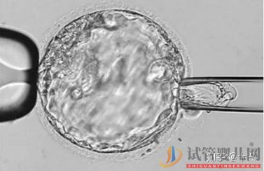 一代、二代、三代试管婴儿究竟有什么区别(图4)