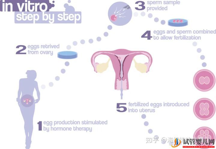 试管婴儿1代、2代、3代、4代哪个最好(图1)