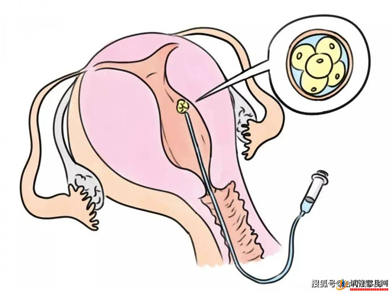 试管胚胎不是你想移植就能移，需要满足这些条件！(图1)