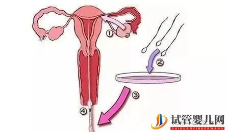 成功的女人,花50万做试管婴儿,试管过程你得知道(图11)