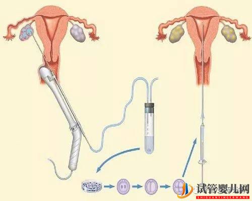 试管婴儿的一个基本流程和周期时间(图4)