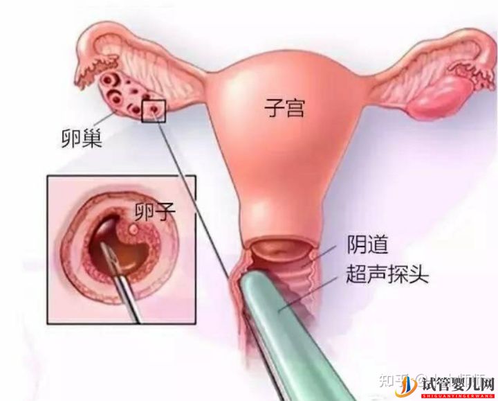 试管婴儿流程&费用(图3)