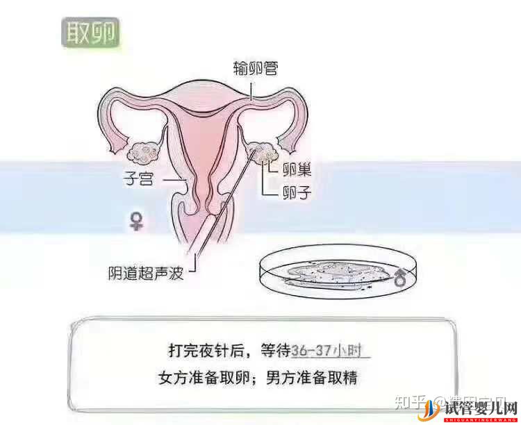 试管婴儿流程图,拿走不谢(图4)