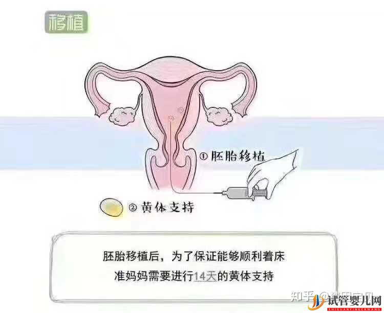 试管婴儿流程图,拿走不谢(图6)