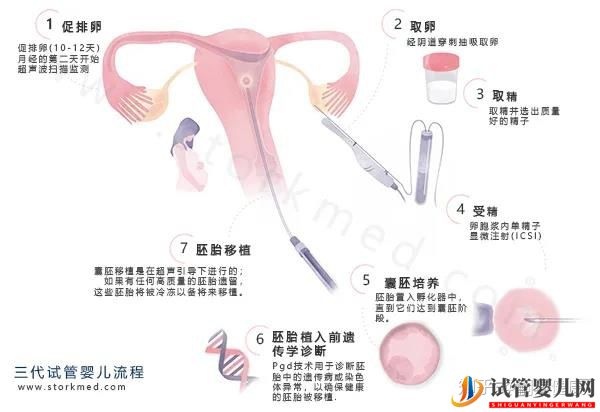 这张《第三代试管婴儿流程图》,一目了然,(图1)