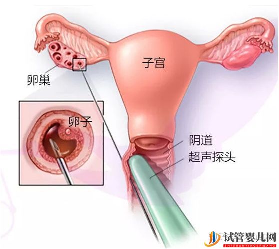 做试管卵泡正常内膜厚度多少才正常_90%的患者不知道(图4)