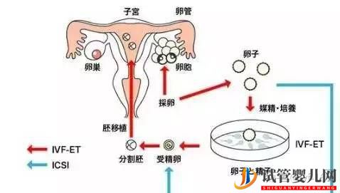 试管婴儿的历史及其发展过程(图7)