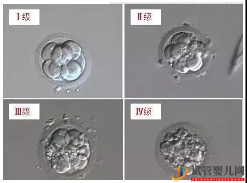 试管婴儿里胚胎碎片是什么呢？(图2)