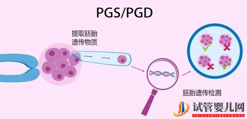 探索美国试管婴儿费用清单(图2)