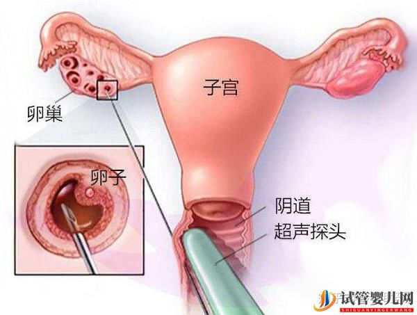 美国试管专家提高试管成功率的有效方案(图8)