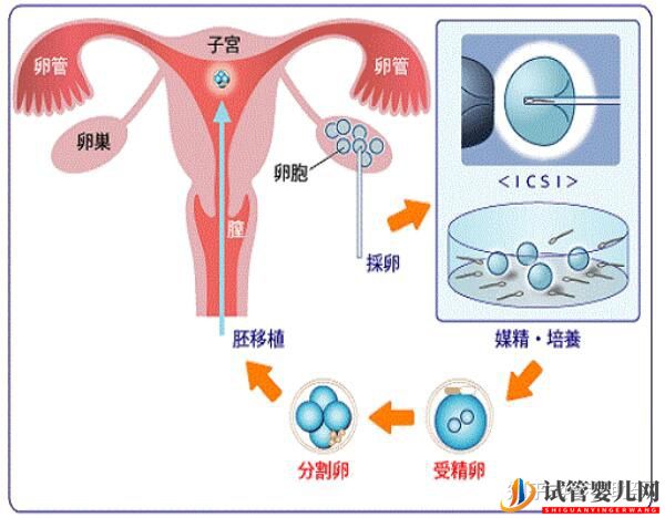 美国试管专家讲解人工授精和试管婴儿的区别(图3)