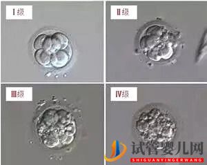 泰国试管婴儿鲜胚，囊胚，冻胚，哪个移植成功率更高(图1)