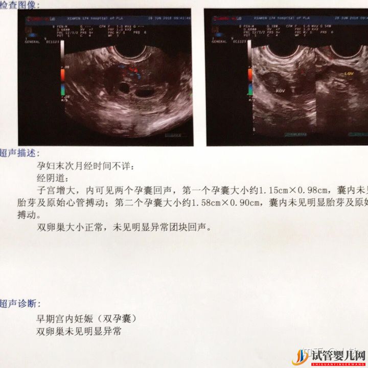 感觉很多人做试管生的都是儿子(图5)