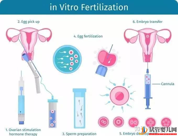 试管周期是什么意思_一个周期要多久(图1)