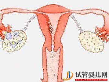 试管婴儿超详细全流程(图3)