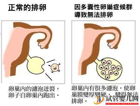 试管婴儿成功诞生有多难(图6)