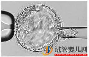 第三代试管婴儿真的最好最先进吗_国内哪里可以做(图6)