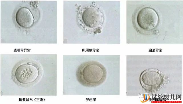 夫妻染色体正常,但胚胎染色体异常,什么原因引起(图5)