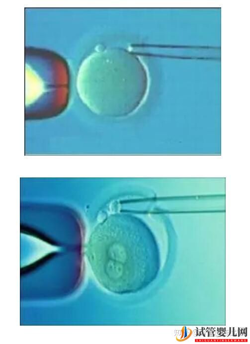 三代试管知男女的必经之路—胚胎活检术(图2)