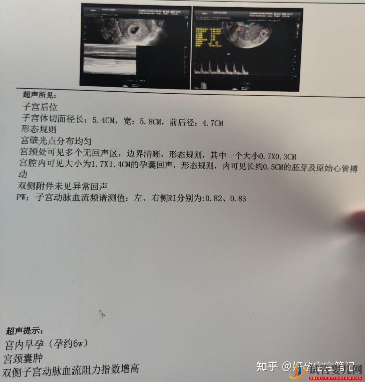 25岁就走上非常艰辛的试管婴儿求子之路,感恩志愿者(图2)