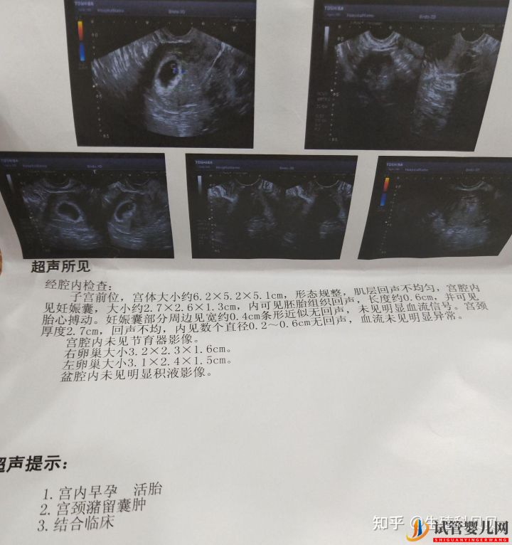 40岁卵巢早衰150斤,移植一次成功,怎么做到的(图1)