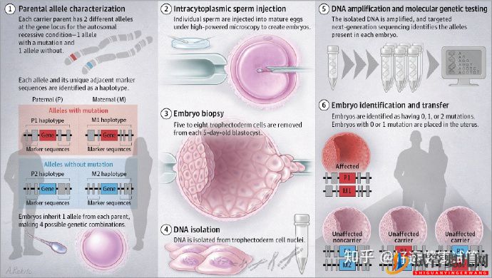 无家族遗传病史的夫妻有必要做第三代试管(图4)