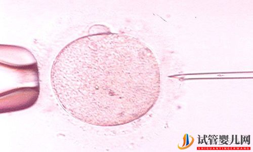 试管婴儿与自然受孕截然不同(图3)