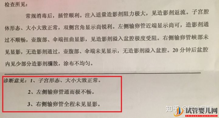 女人做了试管人就废了其中的辛酸苦不堪言(图1)