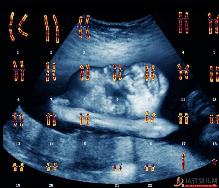 为什么会连续出现胚胎染色体问题,如何避免(图2)