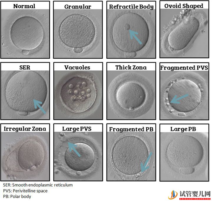 试管婴儿卵子质量完整指南-卵子质量完整攻略(图2)