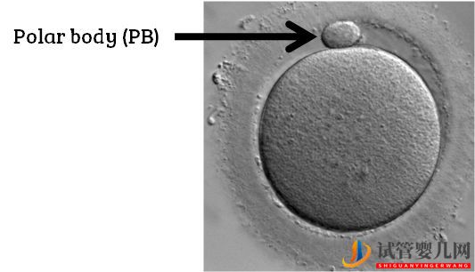 试管婴儿卵子质量完整指南-卵子质量完整攻略(图6)