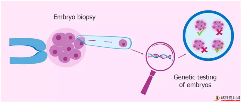 一个典型的PGD三代试管治疗周期是怎样的？(图1)