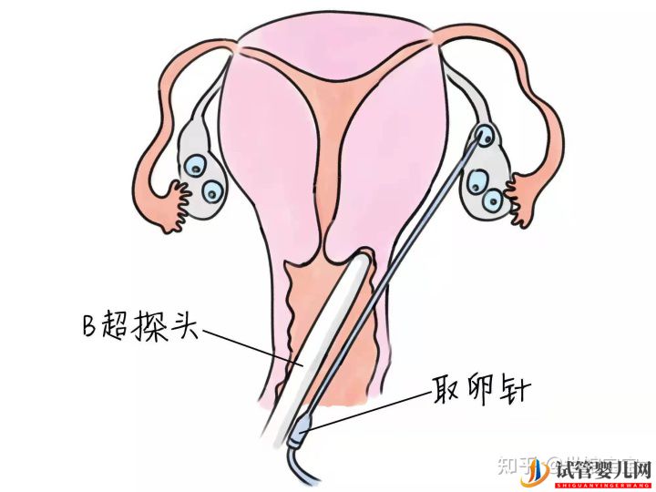 很多人说试管婴儿可能不会是自己亲生的(图1)