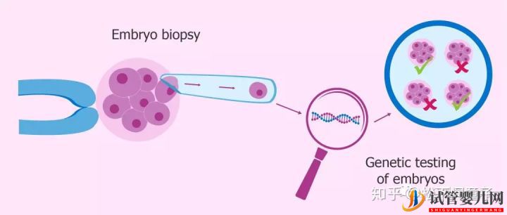 关于美国试管婴儿技术的问题一网打尽(图4)