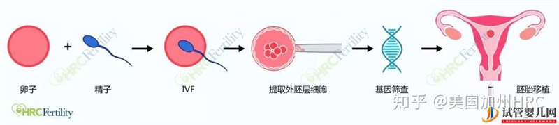 要去美国看病别怕!小C带您全面了解美国试管婴儿(图13)