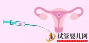 泰国三代试管生男孩可以健康活到几岁(图1)