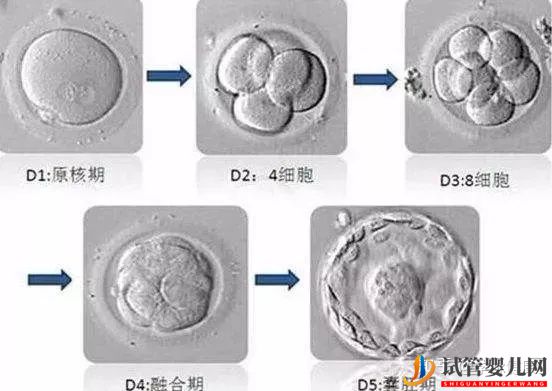 中美试管婴儿的差异在哪里(图3)