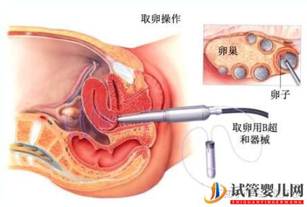 干货分享——泰国试管婴儿详细流程攻略(图5)