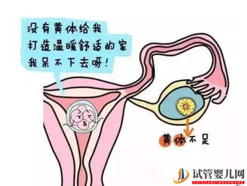 女性黄体功能不全可以选择试管婴儿吗(图1)