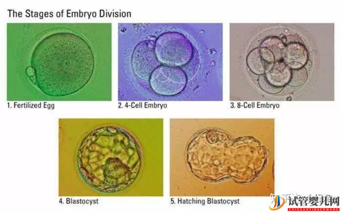囊胚级别划分,什么级别的囊胚成功率最高(图7)