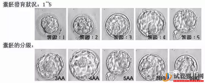 囊胚级别划分,什么级别的囊胚成功率最高(图5)