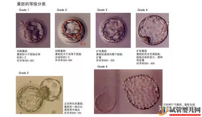 囊胚级别划分,什么级别的囊胚成功率最高(图4)