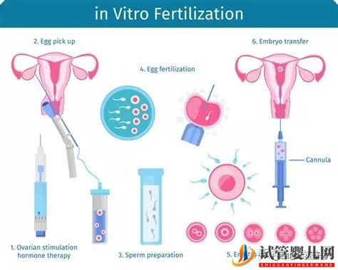 同性恋人赴美国试管婴儿应该做什么准备(图4)