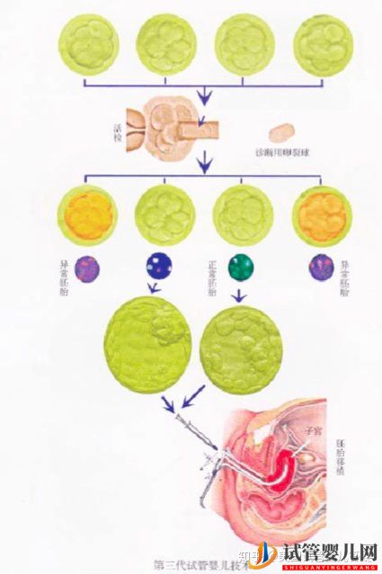 到底要不要去美国做试管婴儿(图1)