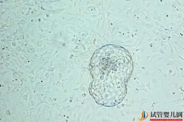 美国试管婴儿技术正解-常见的4个问题解读(图3)