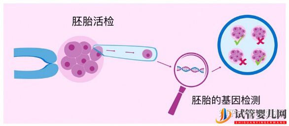 阿里试管婴儿的利弊分析(图1)