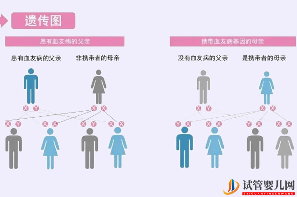 血友病想生育，做试管选择性别避免遗传给下一代(图2)