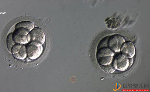 2pn胚胎是不是优质胚胎？移植成功率说明了一切(图1)