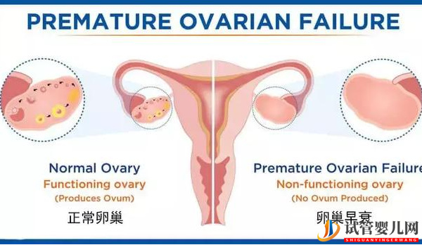 amh0.22卵巢早衰几率大(图1)